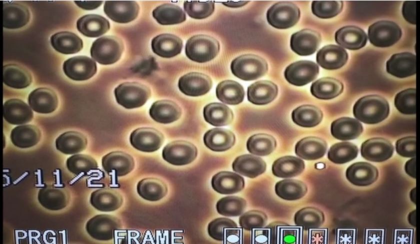 healthy-red-cells.jpg